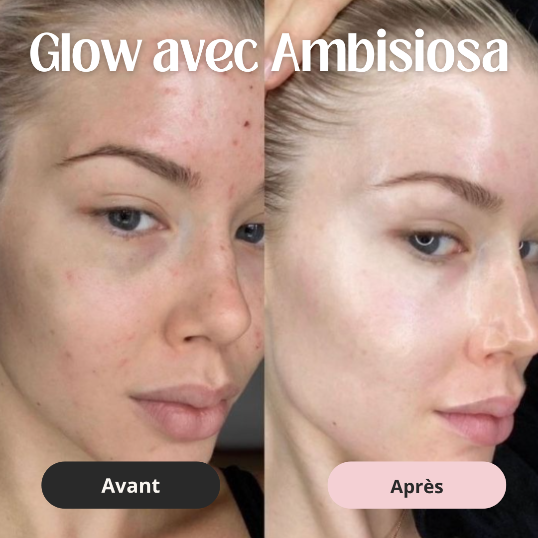 💗 Masque à bulles oxygénant - Éclat immédiat