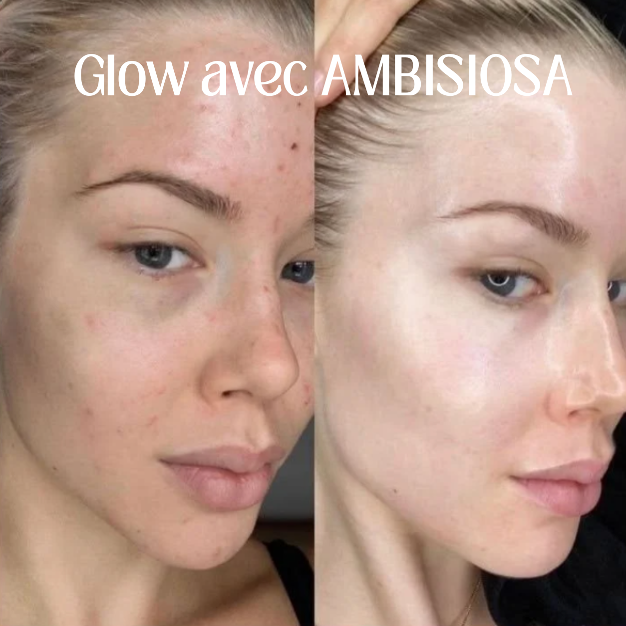 Masque à bulles oxygénant - Éclat immédiat