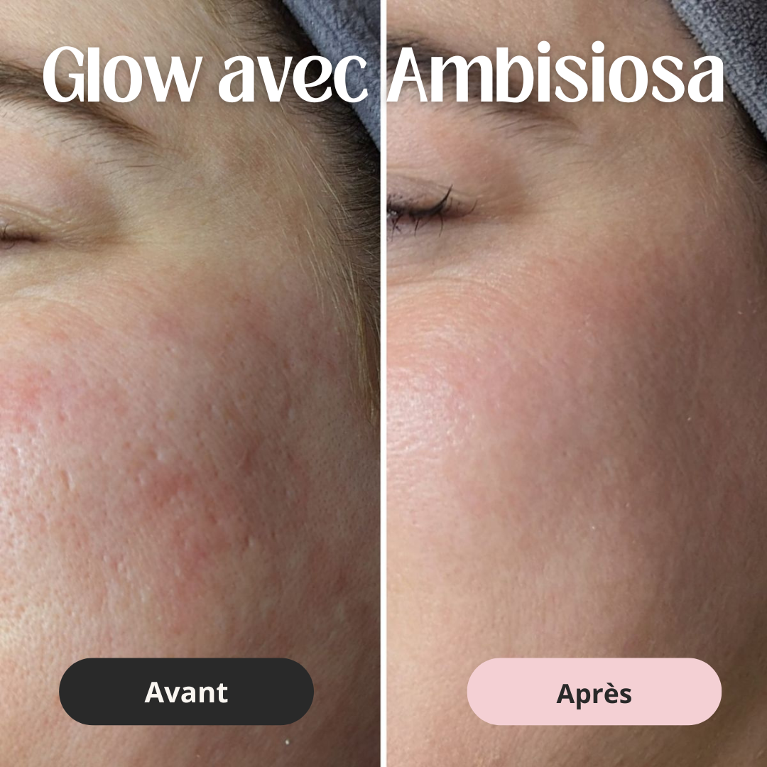💗 Masque à bulles oxygénant - Éclat immédiat