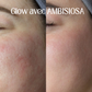 Masque à bulles oxygénant - Éclat immédiat